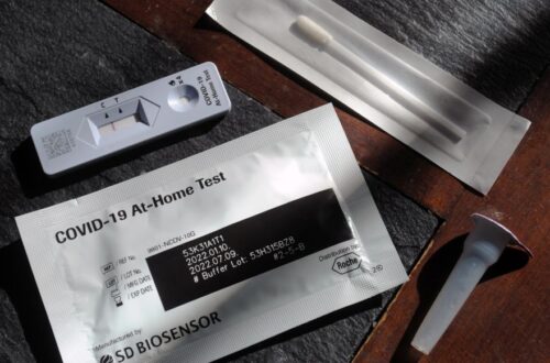 Evde laboratuvar testleri: Güvenilir ev test kitleri seçimi ve sonuç yorumu